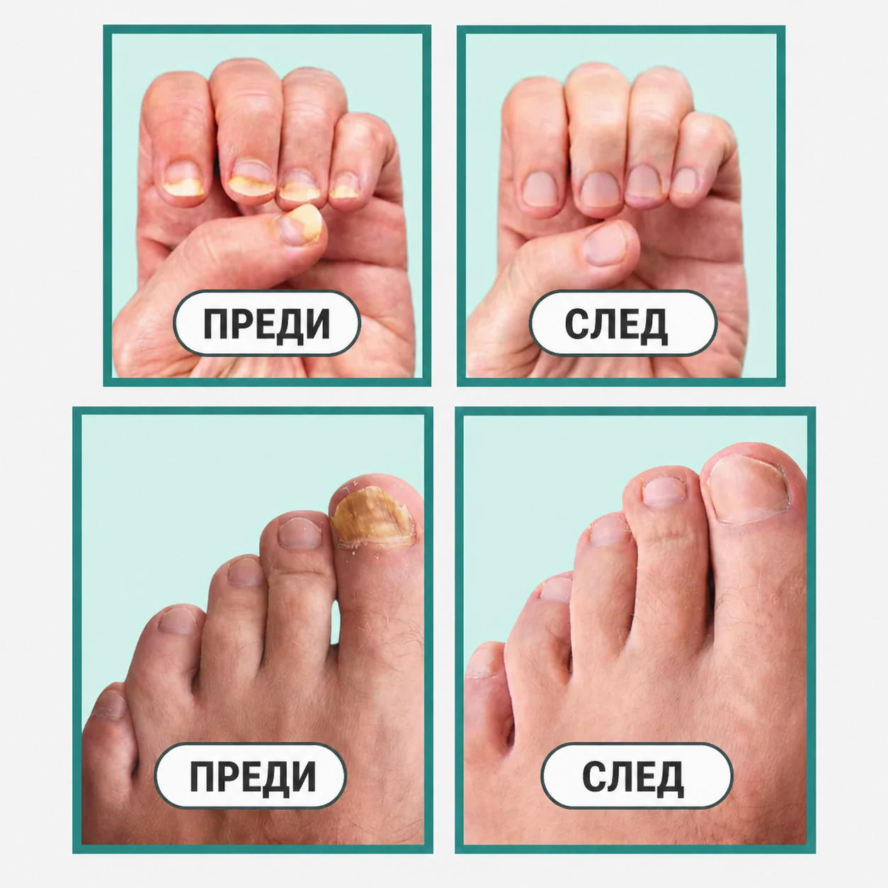 Уред OrthoVital