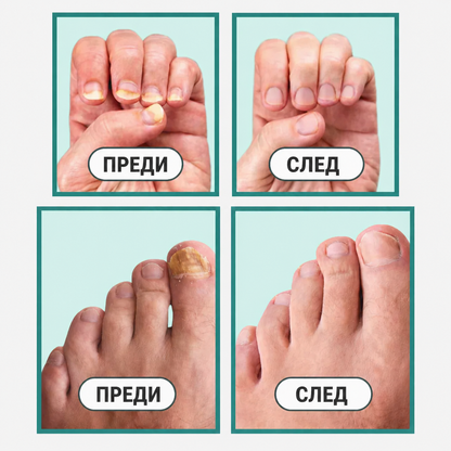 Уред OrthoVital