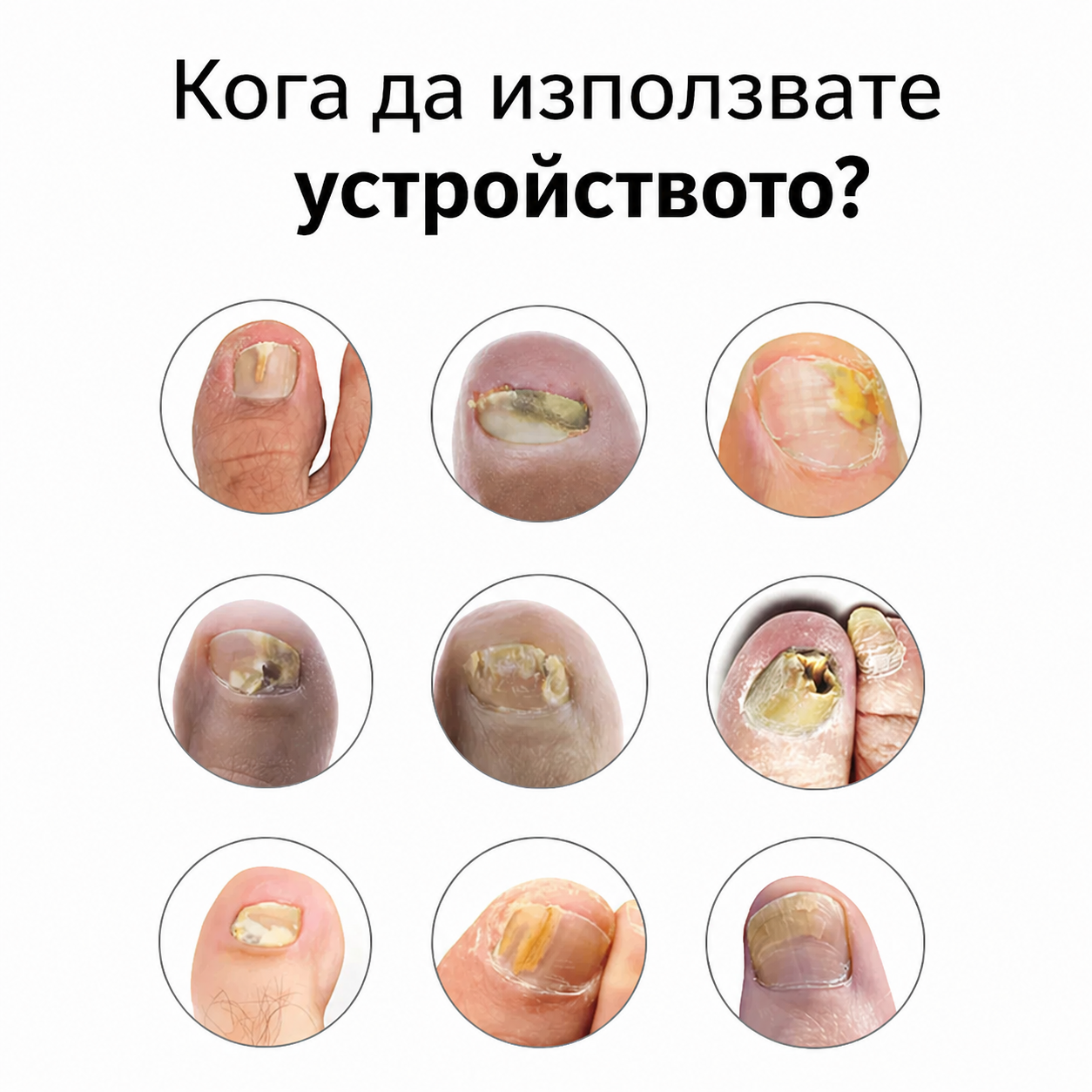 Уред OrthoVital